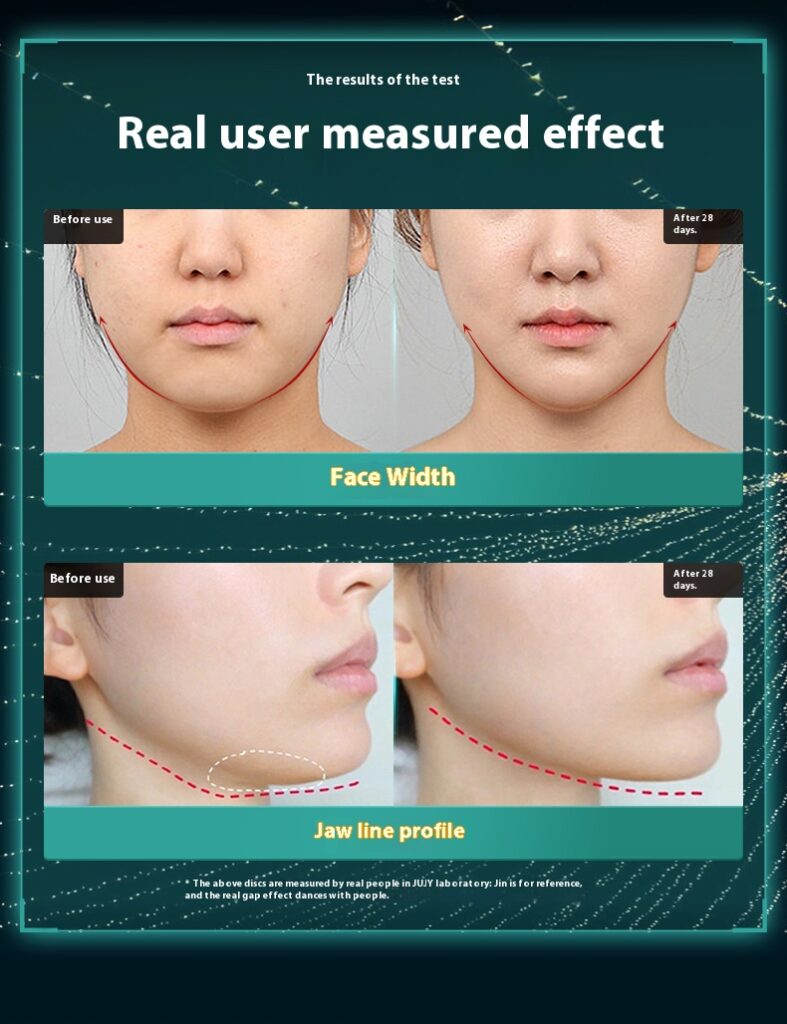 NF002 Collagen Light  Beauty Device