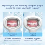 PD-01 Dental plaque detector